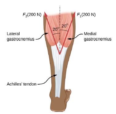 F(200 N) Lateral gastrocnemius Achilles' tendon 20% 20 F(200 N) Medial gastrocnemius