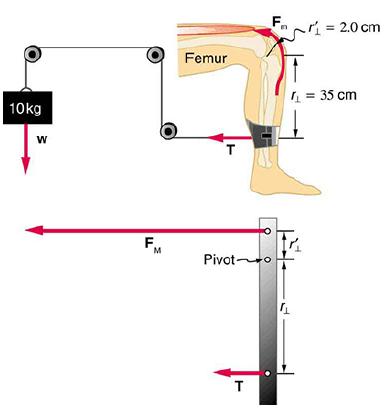 10kg W F, M Femur T FA  = 2.0 cm Pivoto T  = 35 cm
