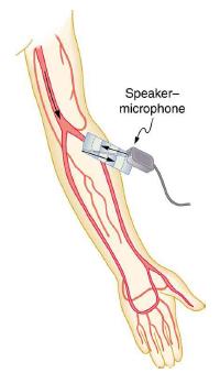 Speaker- microphone