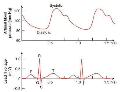 Arterial blood pressure (mm Hg) Lead Il voltage (m V) 120 100 1.0 0.5 0 -0.5 --- P Diastolic R Q Systolic S