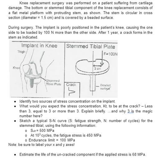 Knee replacement surgery was performed on a patient suffering from cartilage damage. The bottom or stemmed