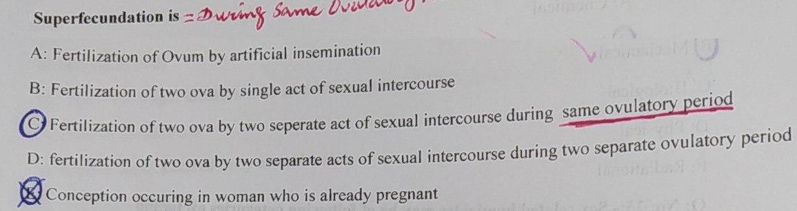 Superfecundation is =Dwimg Same A: Fertilization of Ovum by artificial insemination B: