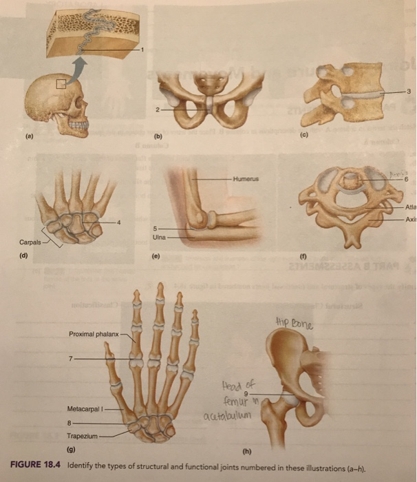 (a) Carpals- (d) Proximal phalanx 7 Metacarpal I 8 2 (b) 5 Ulna (e) of Humerus Head of femur in acetabulum