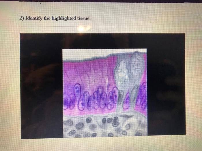 2) Identify the highlighted tissue. Bo osno