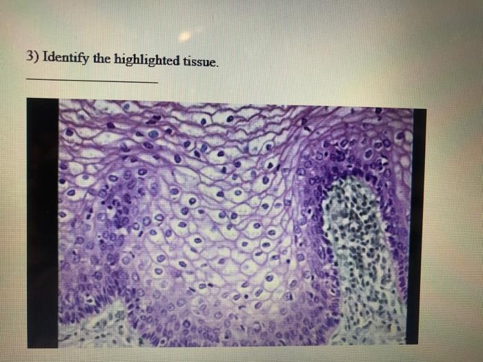 3) Identify the highlighted tissue.