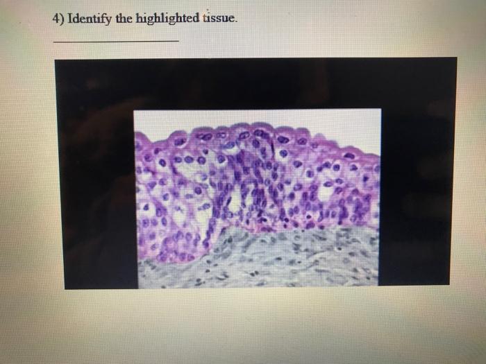 4) Identify the highlighted tissue.