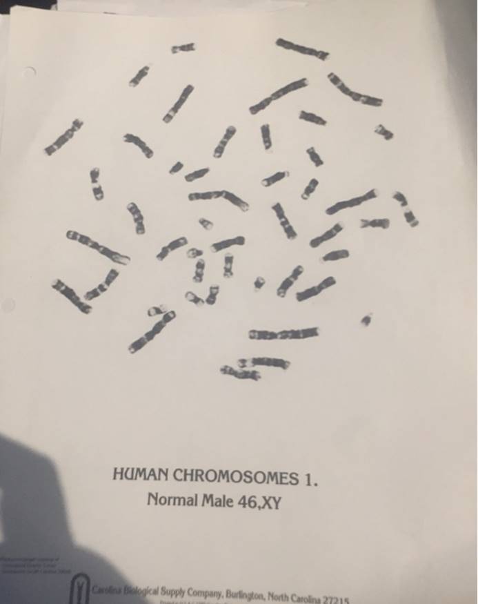 N HUMAN CHROMOSOMES 1. Normal Male 46,XY M Carolina Biological Supply Company, Burlington, North Carolina