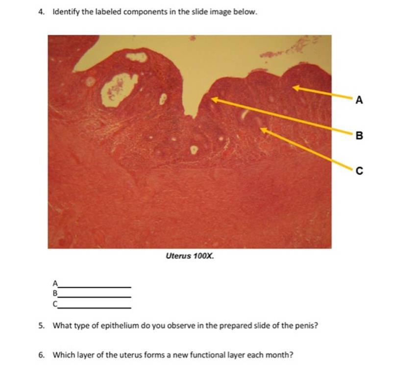 The Reproductive System4. Identify the labeled components in the slide image below.DB?Uterus 100x.?.B5. What type of