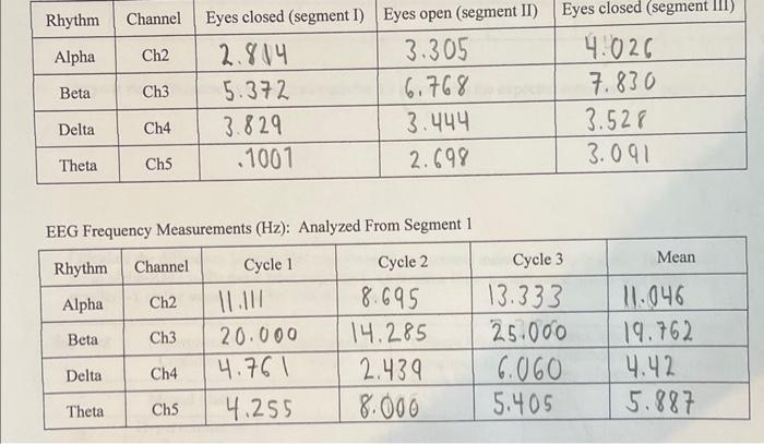 EEG Freauency Measurements ( (mathrm{Hz}) ) : Analyzed From Segment 1