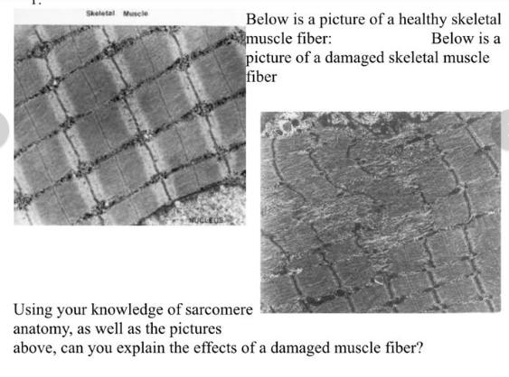 Skeletal Muscle Below is a picture of a healthy skeletal Imuscle fiber: Below is a picture of a damaged skeletal muscle fiber