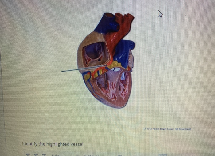 [Solved] Identify the highlighted vessel. k Identi SolutionInn