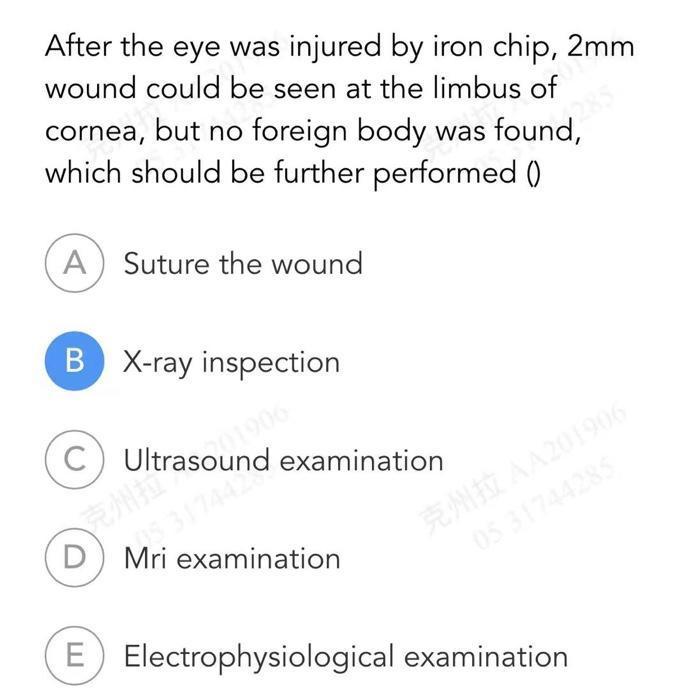 After the eye was injured by iron chip, ( 2 mathrm{~mm} ) wound could be seen at the limbus of cornea, but no foreign body