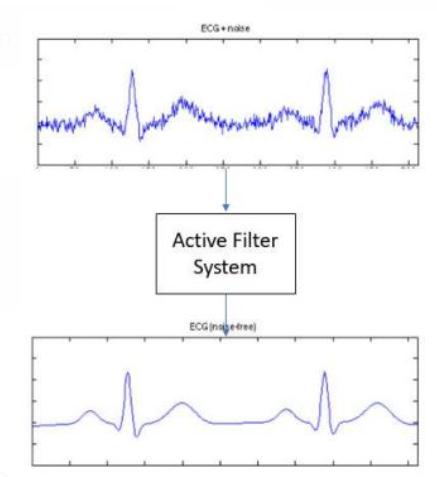 ECG naise Active Filter System ECG Inbetree)