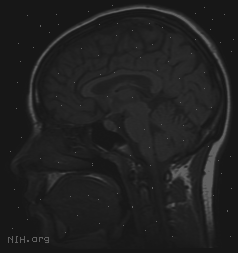 in python Part 1: Implement image enhancement techniques, such as: Histogram stretching
