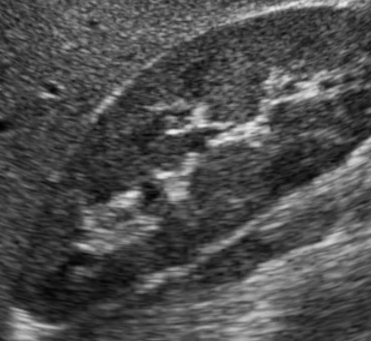 write a matlab code with output figures for Lee filter. Implement noise-adaptive