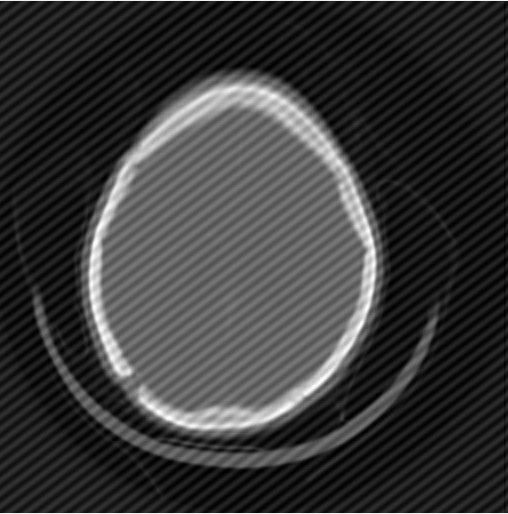  The image interfere.pgm contains an interference pattern of unknown spatial frequency,