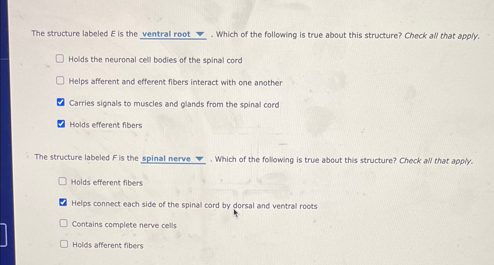  The structure labeled E is the ventral root grad. Which of