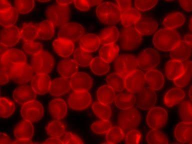 Problem Description: Task 1: For this task, you are going to complete