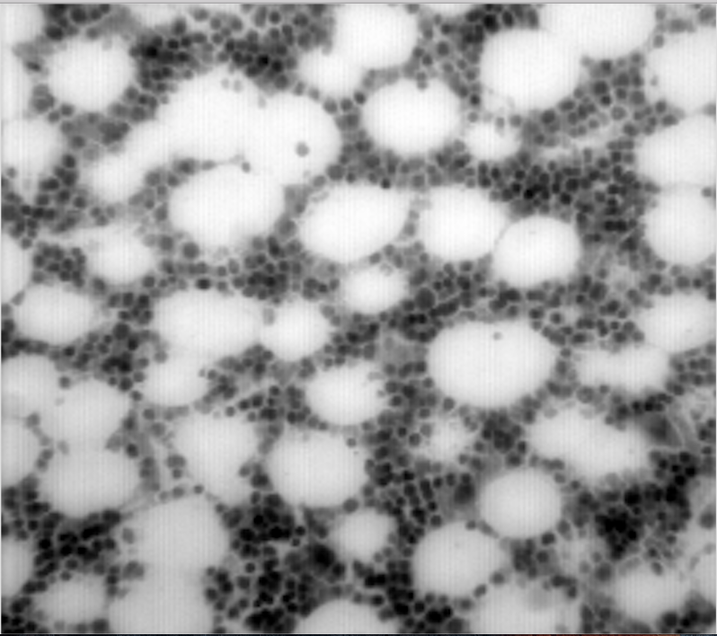 this, it is from Digital Image Processing. Again Just need Question 3.Thank