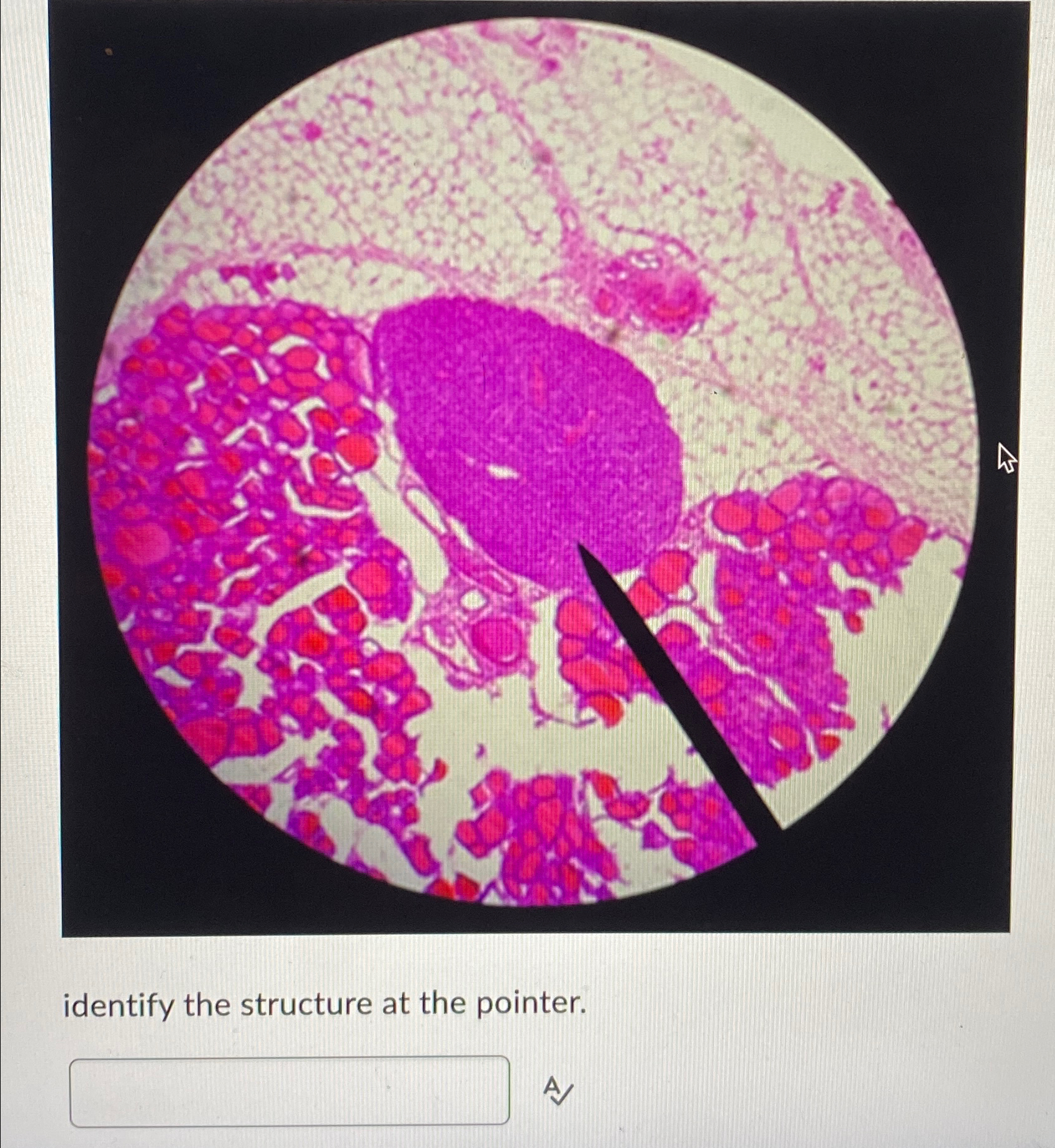  identify the structure at the pointer. A 