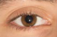 to detect the center and radius of all eye irises found in