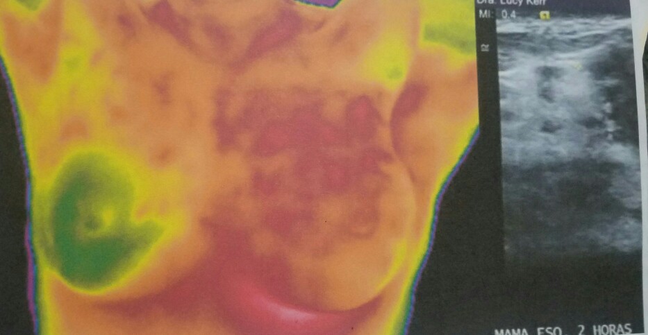 as reference Subject: Breast Cancer, Thermography Class: Programming Examples: Red=Breast Cancer? Green=Healthy?