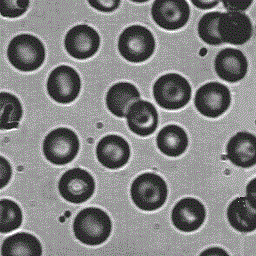 Matlab: Use the discrete wavelet transform, dwt2 in matlab to compress blood256.gif