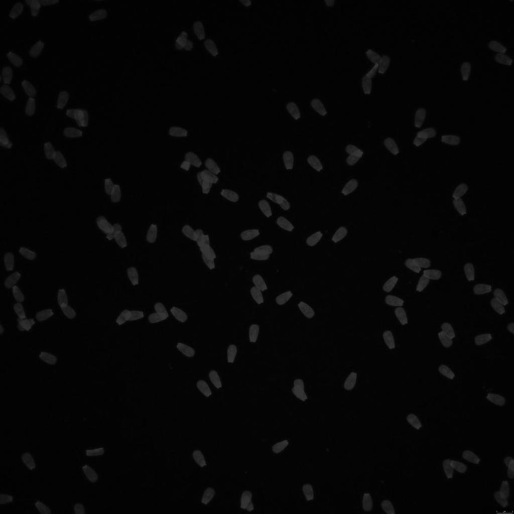Write a MatLab code to count the number of sperm nuclei