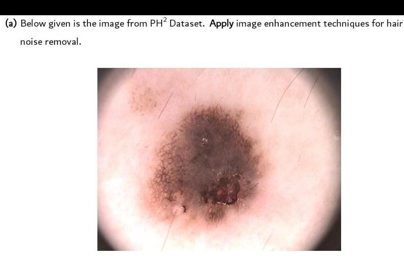  (a) Below given is the image from PHP Dataset. Apply image