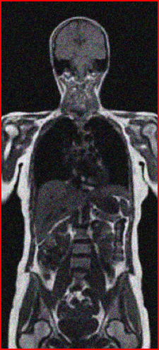 that needs to be used to answer the exercises. 1) BodyMRI.png 2)