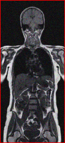BodyMRI_noise1.png 3) BodyMRI_noise2.png 4) BodyMRI_noise3.png 5) BodyMRI_noise4.png 6) BodyMRI_noise5.png 7) BodyPET.png 8)