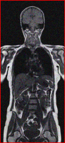 BreastTumorCell.jpg 9) RBC.jpg 10) RBC_blurry.jpg Given below is worksheet containing all the