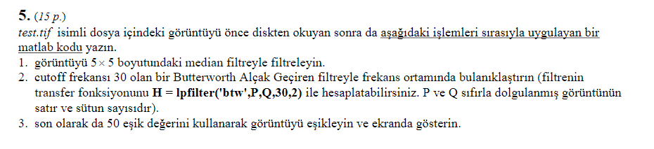  Write a matlab code that first reads the image in the