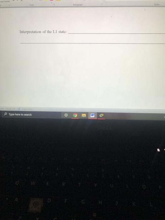 interface's Physical and Data Link layers' default state? Interpret the state shown.