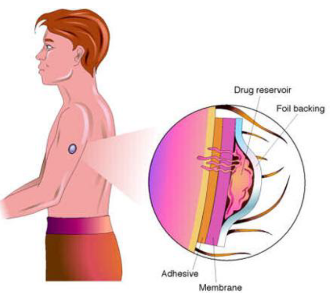 Sketch the initial concentration profile for the transdermal patch below, including the