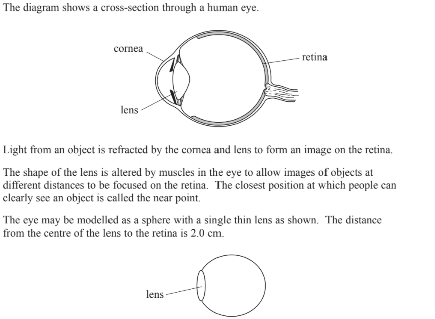 The diagram shows a cross-section through a human eye. Light from