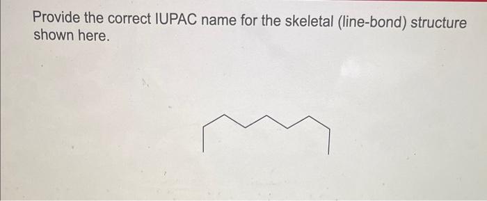 here. Provide the correct IUPAC name for the skeletal (line-bond) structure shown