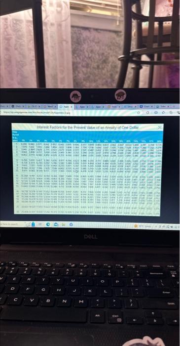 $70,000. You immediately receive $20,000 but must pay your lawyer's fee of