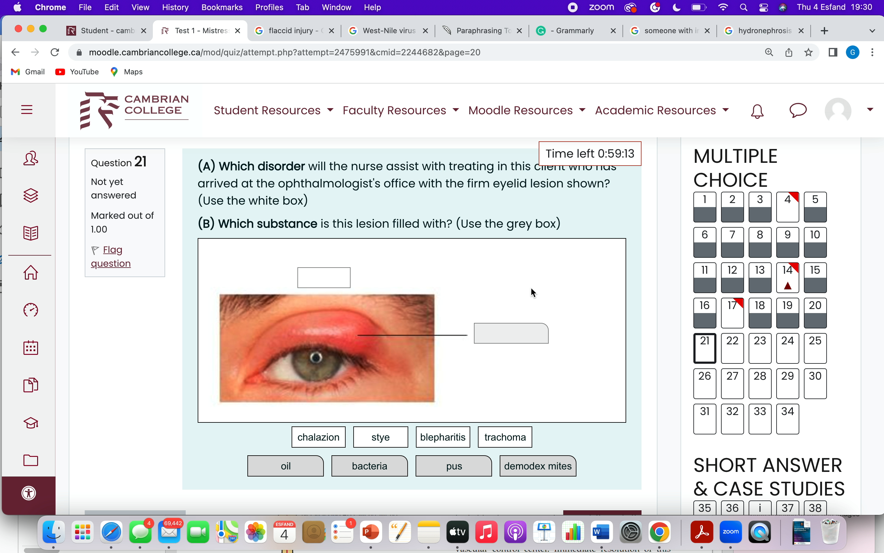 the body from the pathophysiologic aspects of shock. (4 marks) 64 65