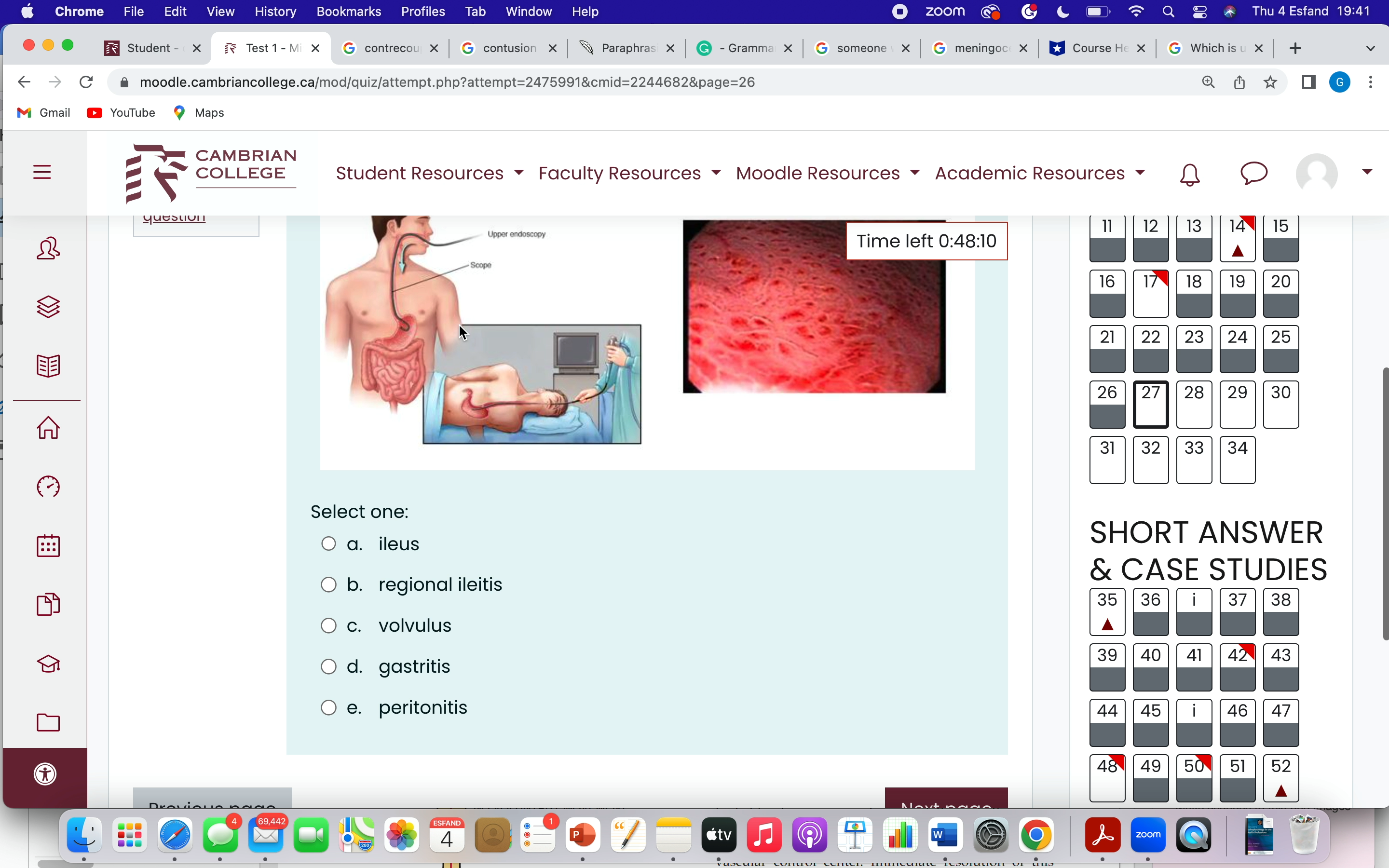 66 67 68 answered Marked out of SE 4.00 A T F