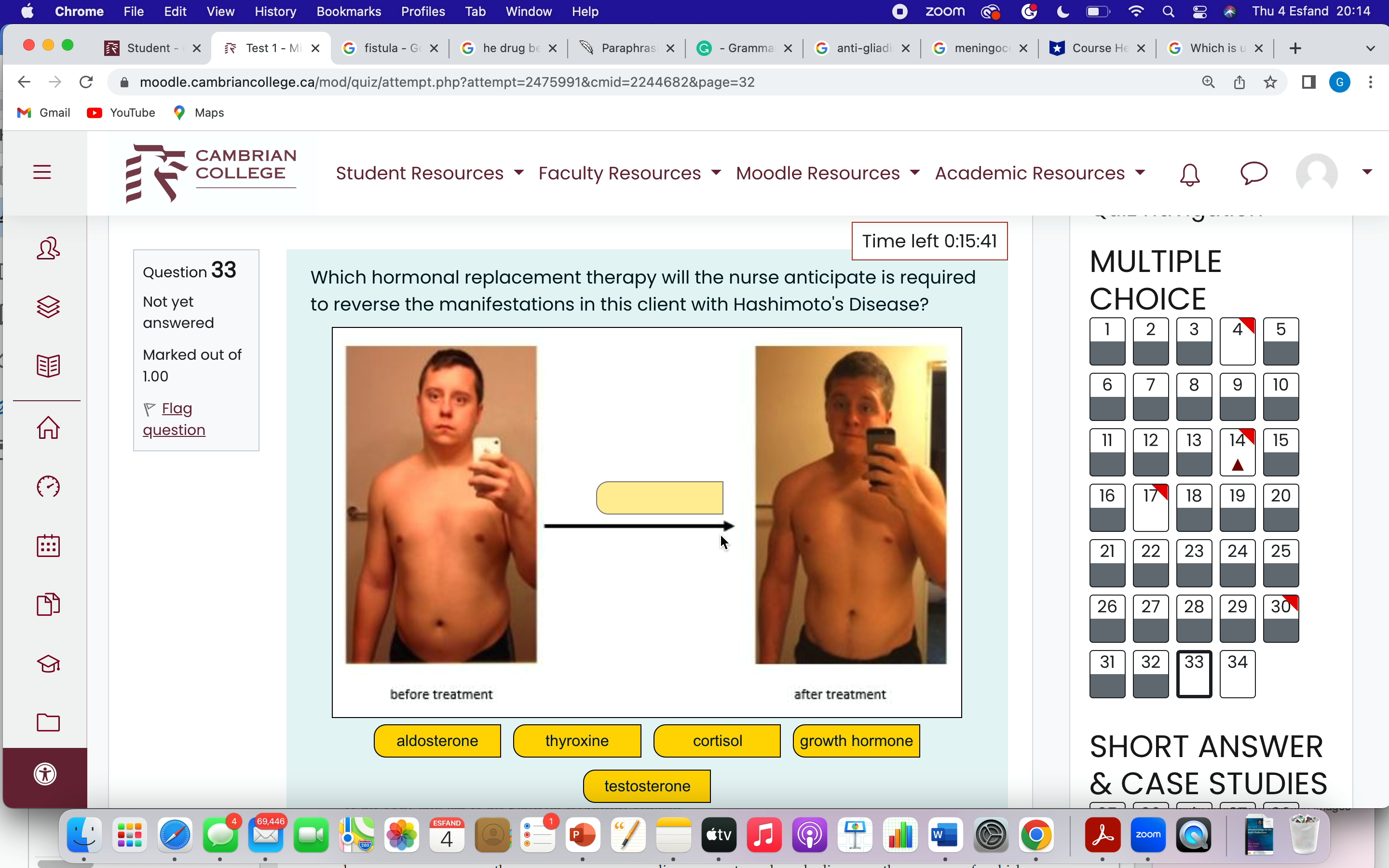 72 73 74 75 76 77 Finish attempt ... Question 63 The