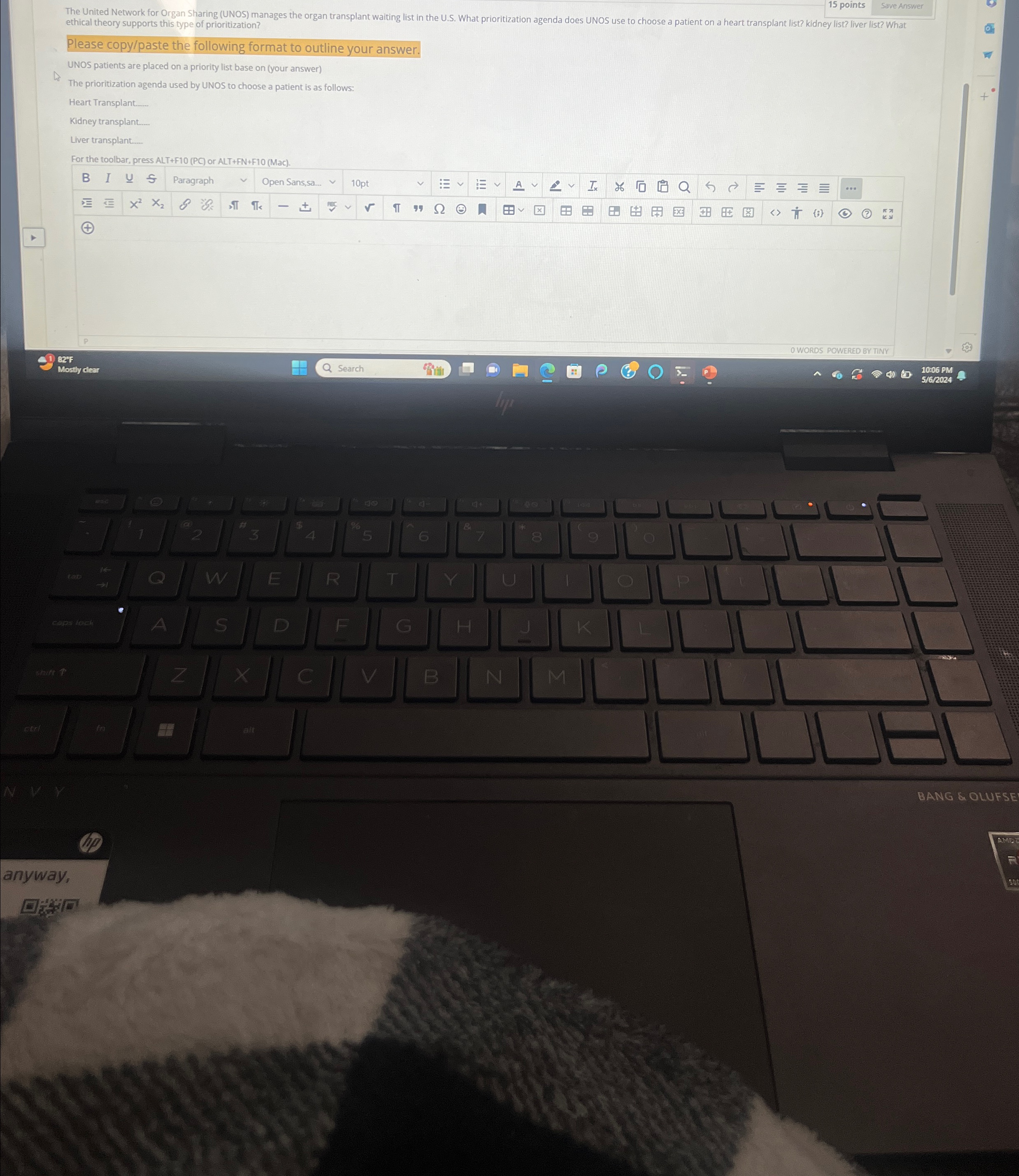  15 points The United Network for Organ Sharing (UNOS) manaes the