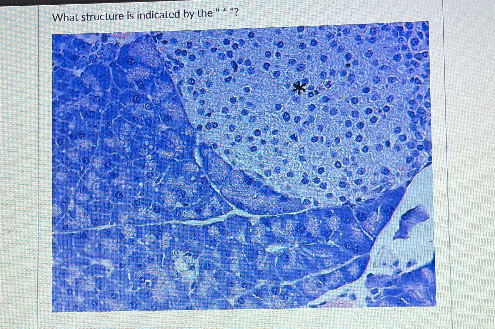 What structure is indicated by the "*"? 