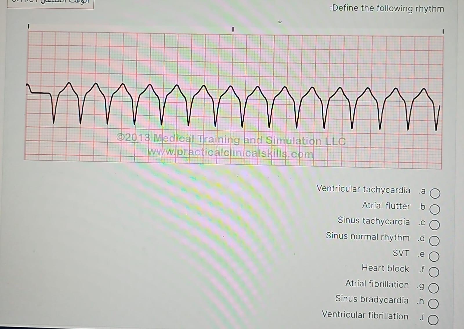  :Define the following rhythm 4 (02013 Medical Training and Simulation LLC
