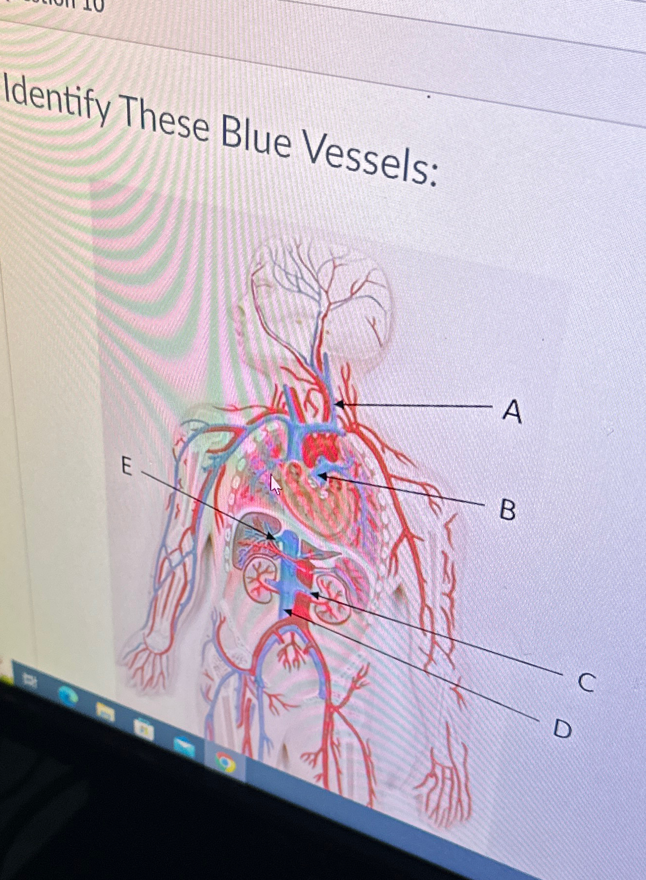  Identify These Blue Vessels: 