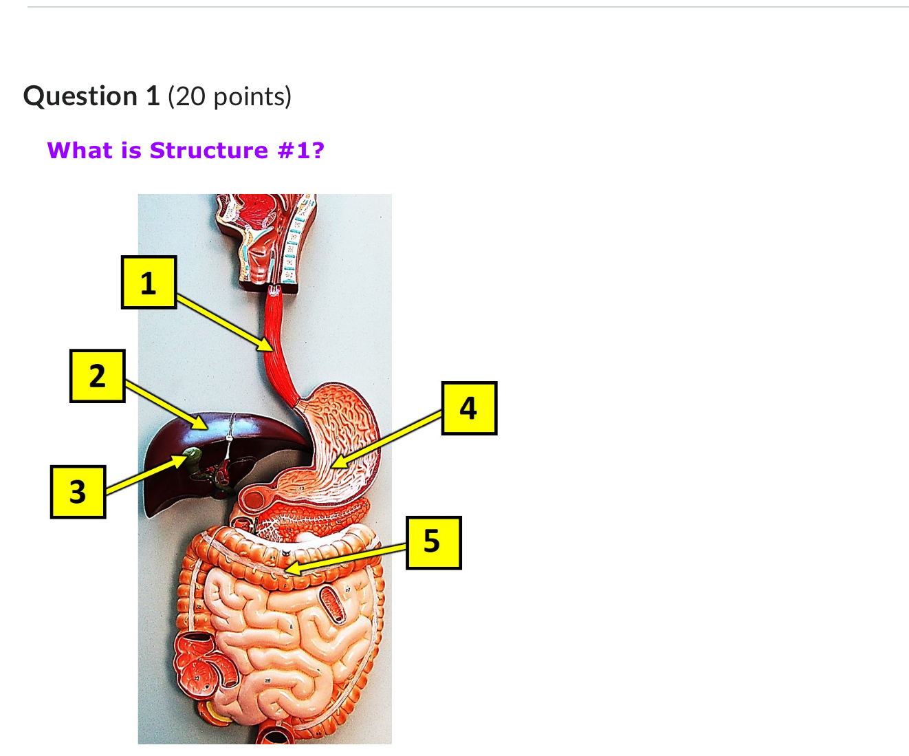  Question 1(20 points) What is Structure #1? 