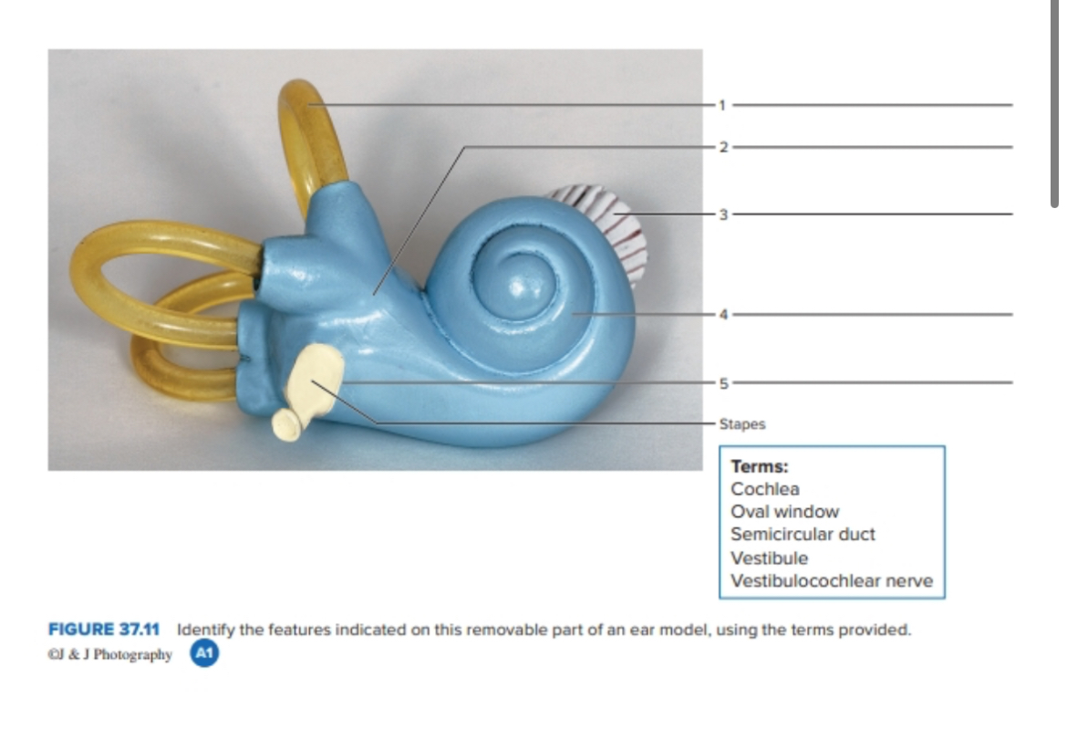  FIGURE 37.11 Identify the features indicated on this removable part of
