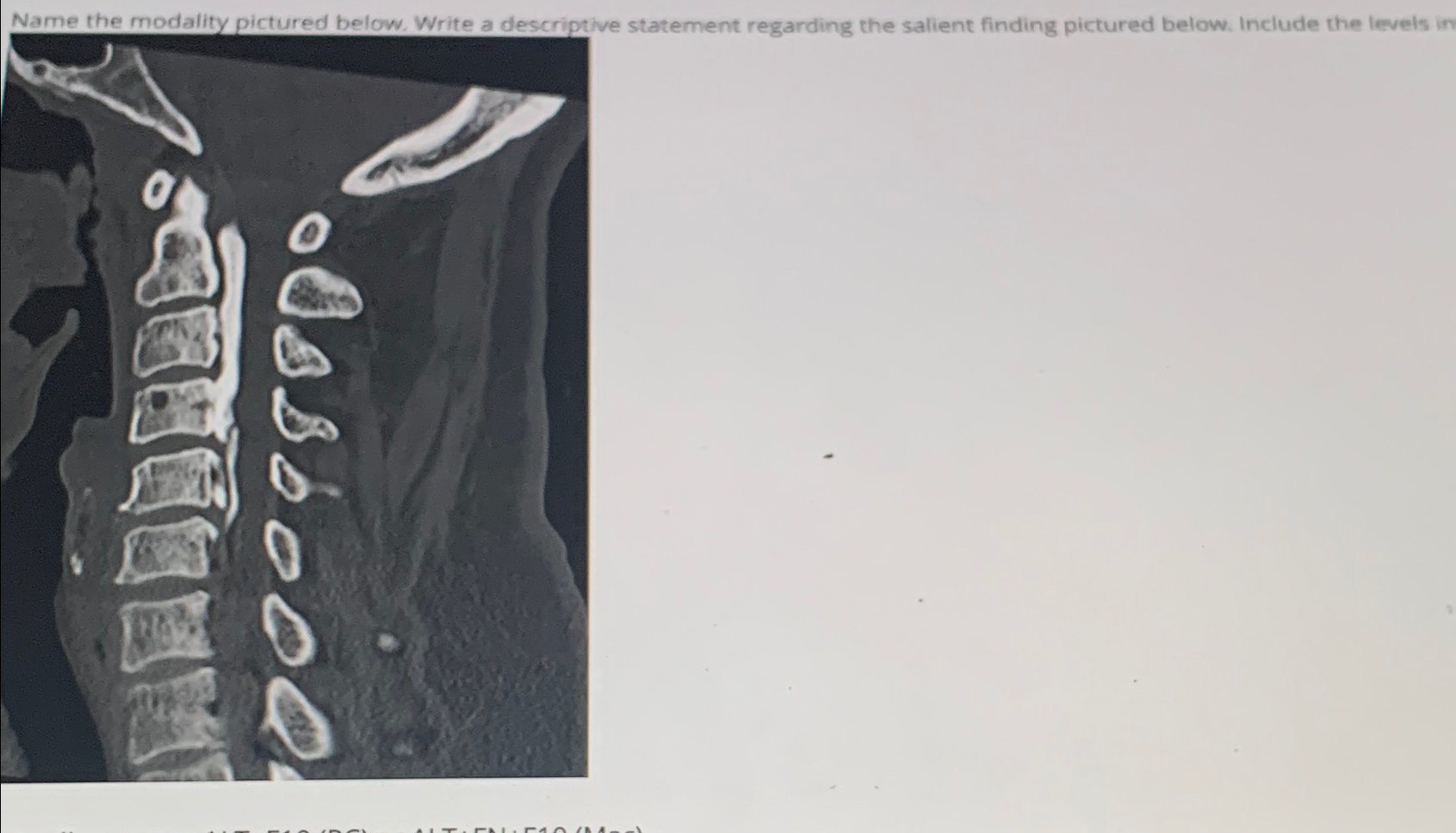  Name the modality pictured below. Write a descriptive statement regarding the