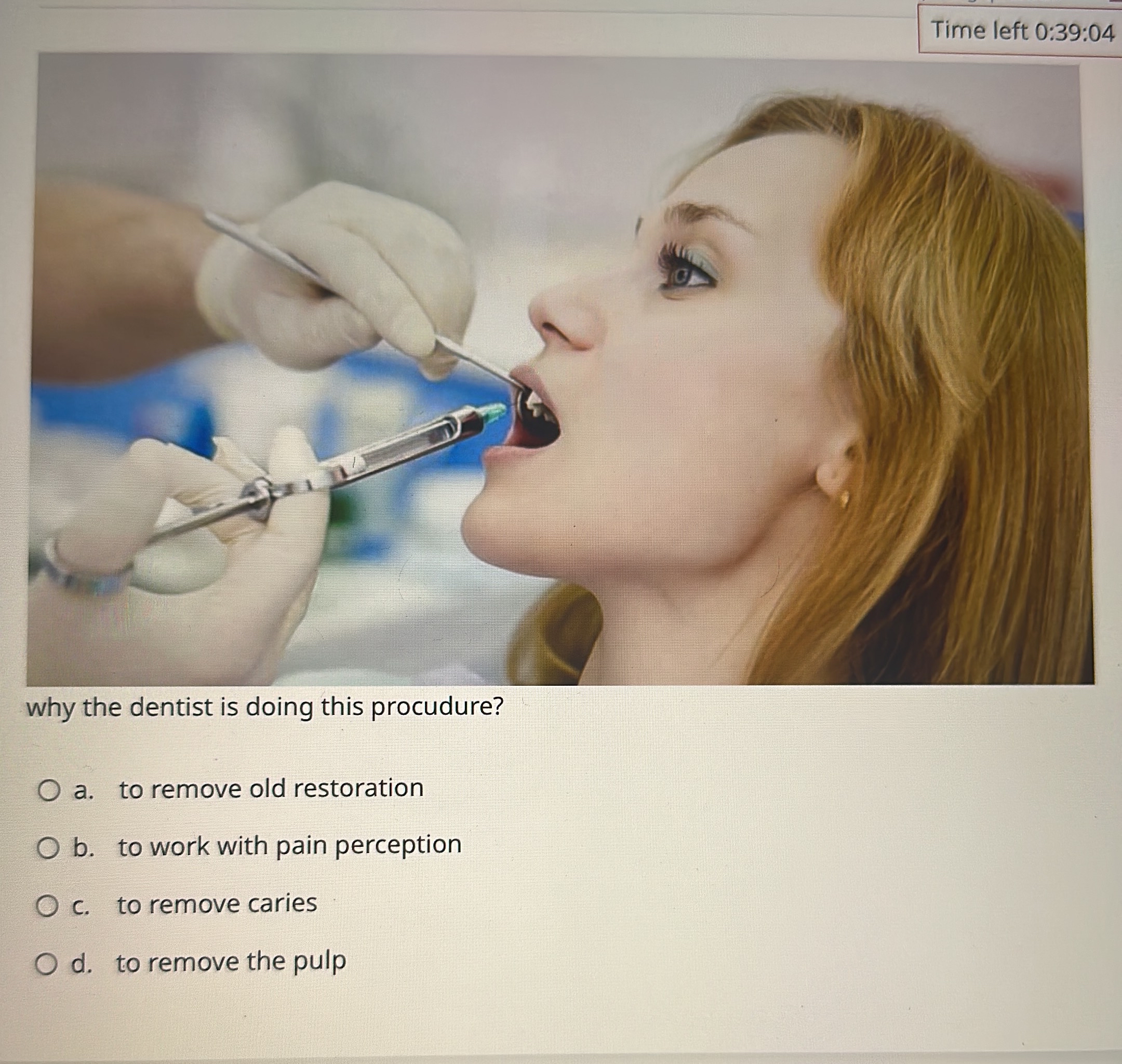  Time left 0:39:04 why the dentist is doing this procudure? a.