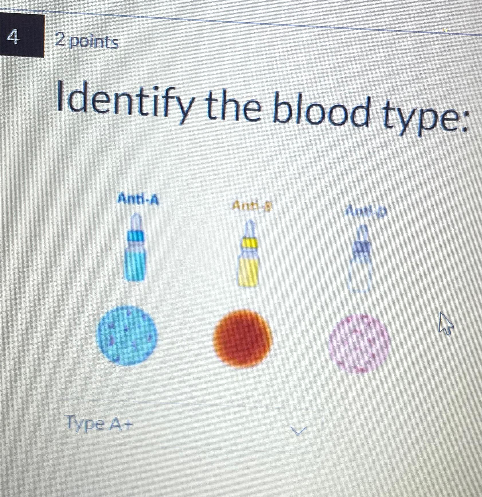  Steps for... 42 points Identify the blood type: Anti-A Anti-8 Anti-D